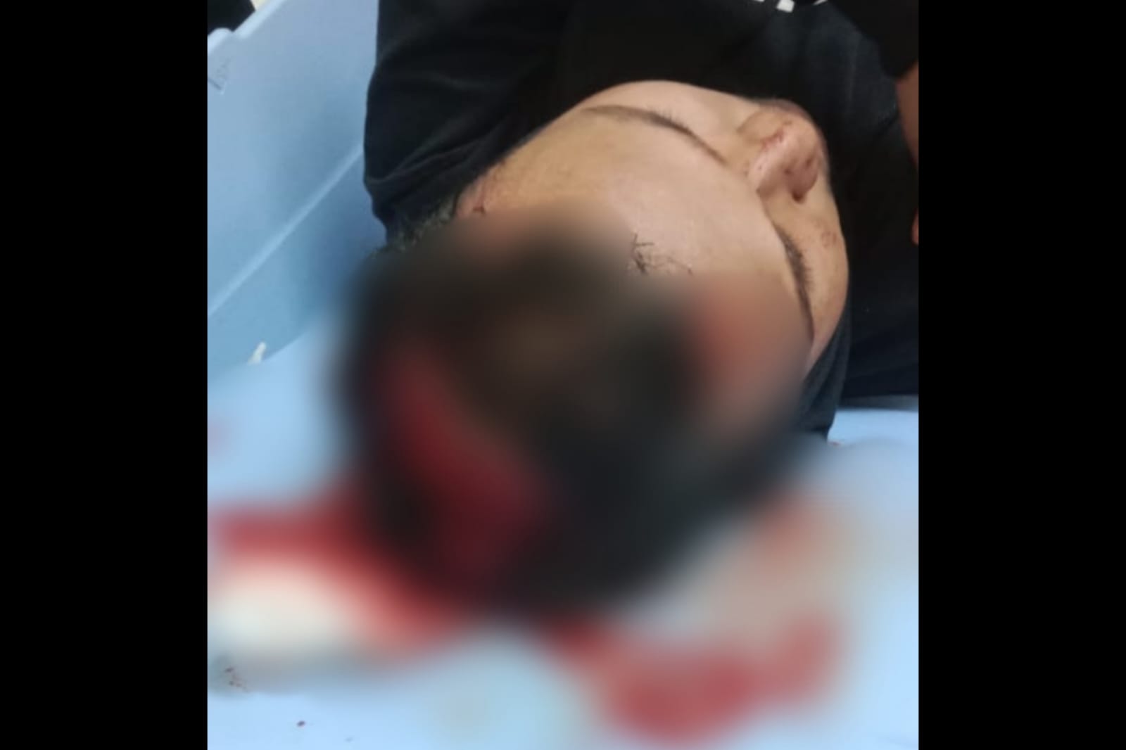 Kepala Pelajar Dibacok Hingga Tengkoraknya Terbuka dalam Tawuran di Balaraja Tangerang
